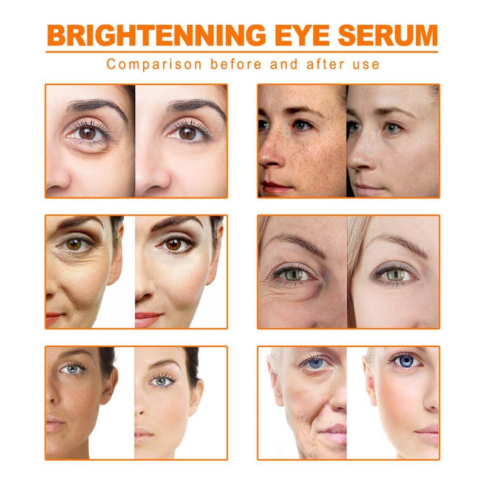 Organic Turmeric Essential Oil 10ml - Pure Therapeutic Grade for Dark Spots